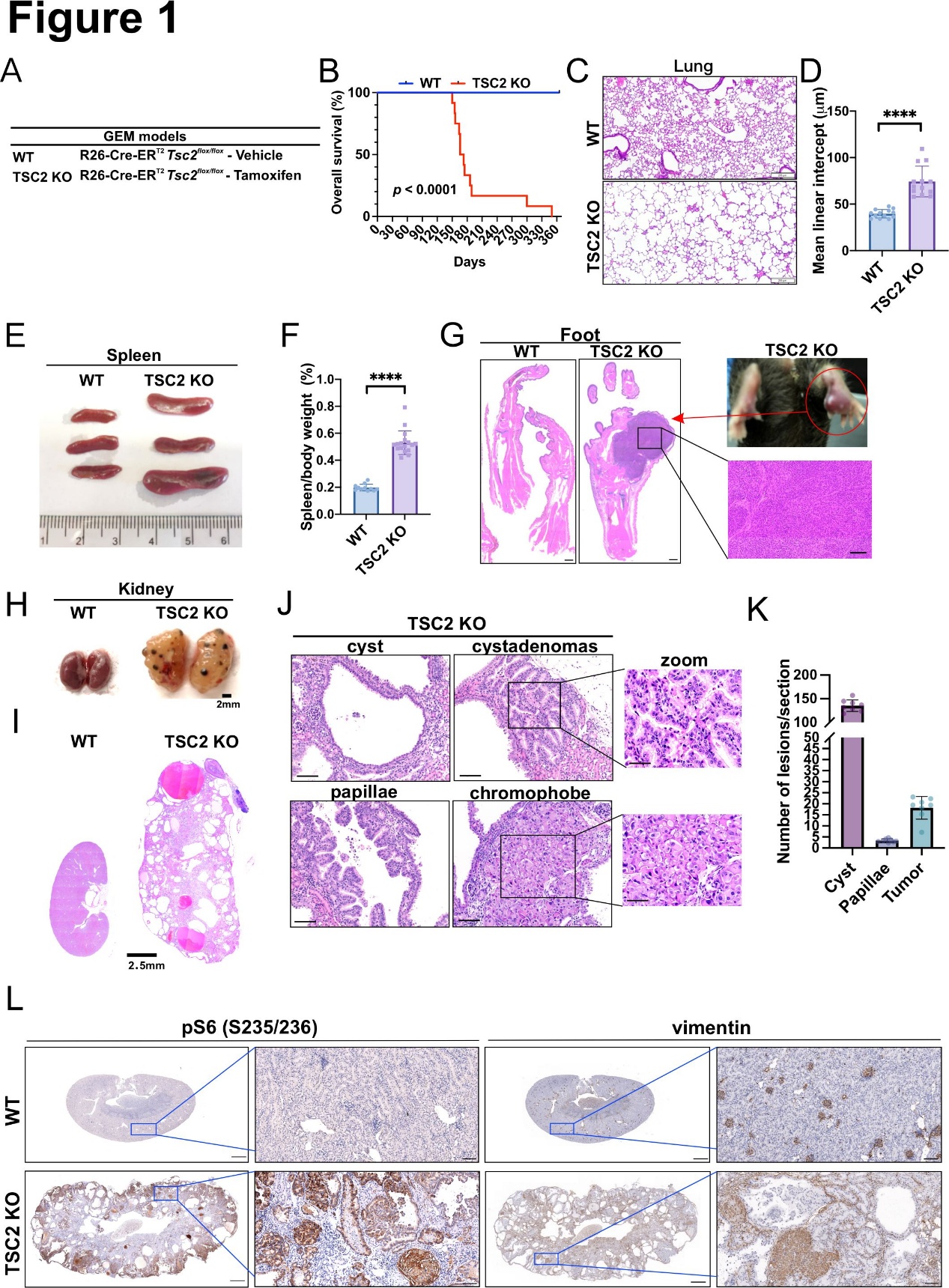 Liu Heng-Jia’s Research Group Publishes in Oncogene | Revealing the Critical Role of B7-H3 in TSC-Associated Renal Cancer and Identifying a New Target for Precision Therapy