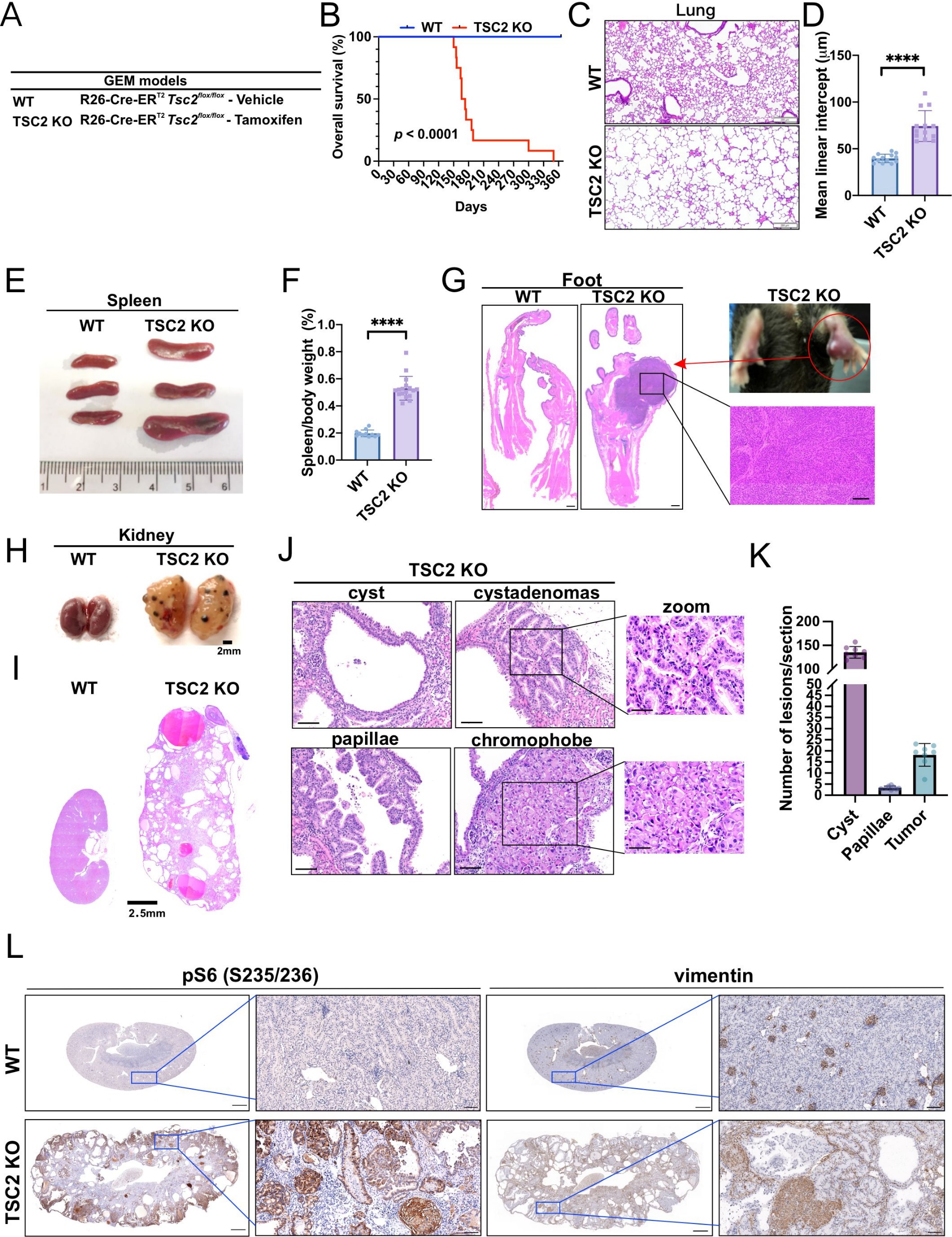 刘恒嘉Liu Heng-Jia课题组在《Oncogene》上发文，揭示B7-H3在TSC相关肾癌中的关键作用，为精准治疗提供新靶点
