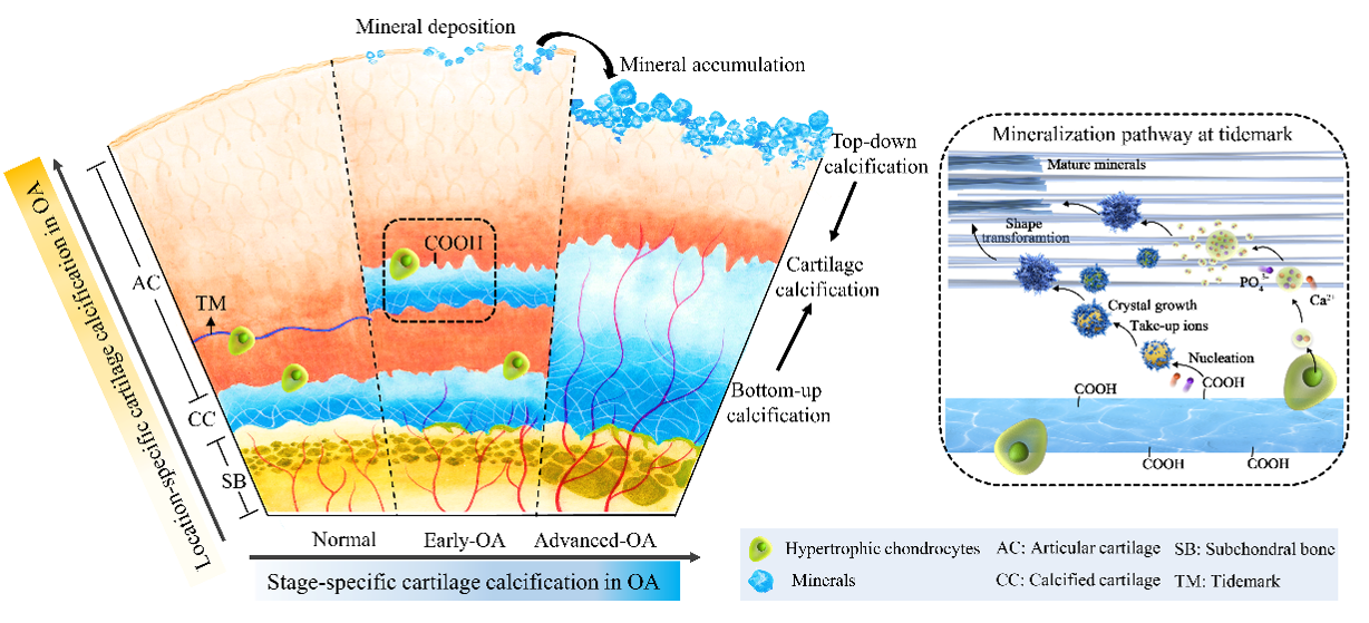意料之外的“三明治”：我院欧阳宏伟教授团队发现人体关节软骨钙化的物质科学机制